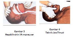 Bantuan Hidup Dasar Gawat Darurat