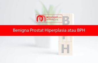 Benigna Prostat Hiperplasia atau BPH, Apa itu? Benigna Prostat Hiperplasia atau BPH