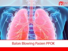 Balon Blowing Pasien PPOK Balon Blowing Pasien PPOK