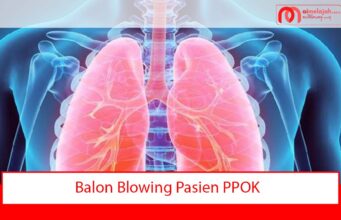 Balon Blowing Pasien PPOK Balon Blowing Pasien PPOK