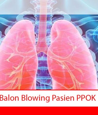 Balon Blowing Pasien PPOK Balon Blowing Pasien PPOK