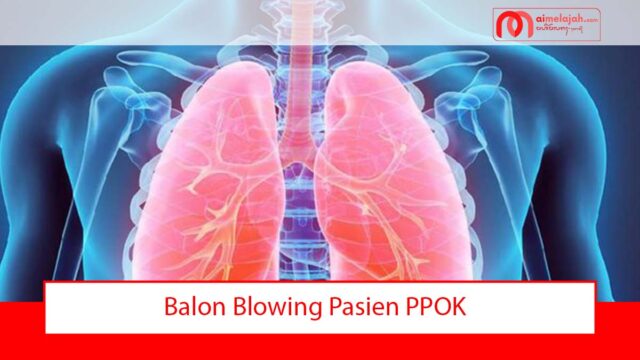 Balon Blowing Pasien PPOK Balon Blowing Pasien PPOK
